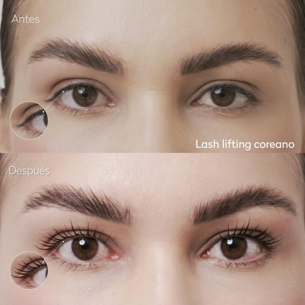 seccion-lifting