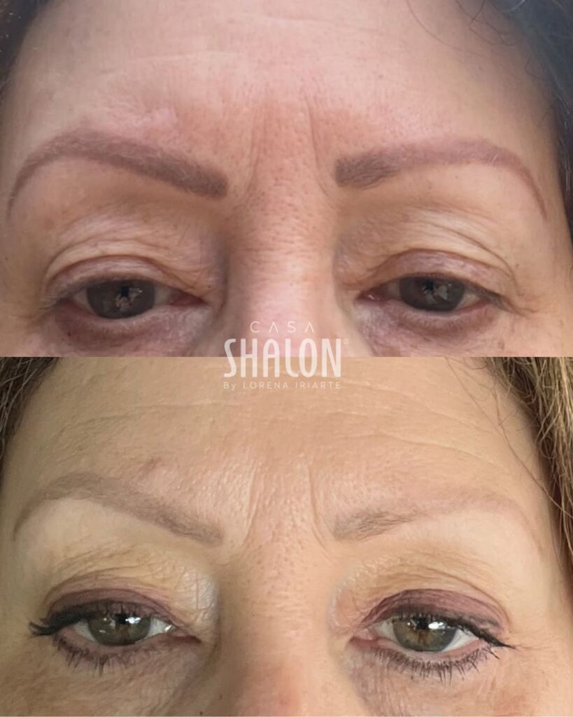 aclarado-de-cejas